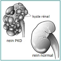 PKD et persan